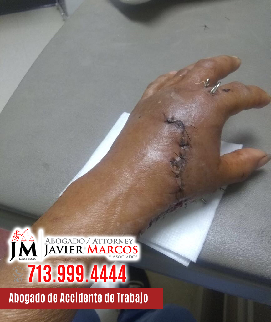 Abogado de Accidente de Trabajo | Abogado Javier Marcos | 713.999.4444 Abogado de Accidente de Trabajo | Abogado Javier Marcos | 713.999.4444