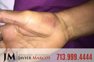 Herido en el Trabajo | Abogado Javier Marcos | 713.999.4444