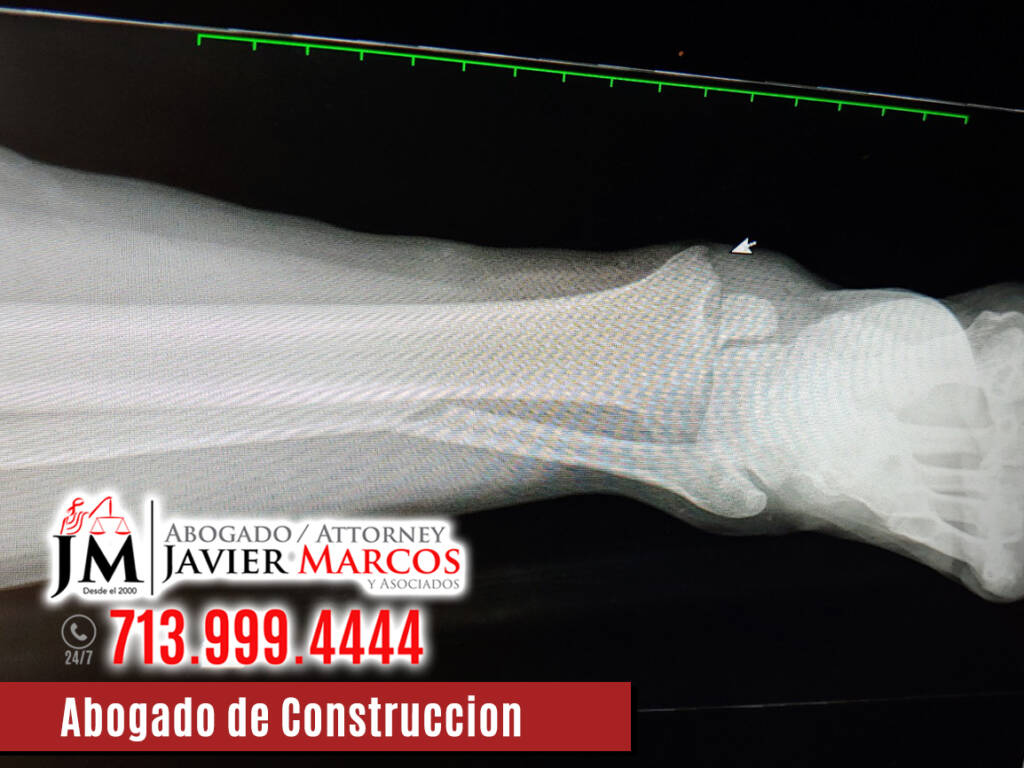 Abogado de Construccion | Abogado Javier Marcos | 713.999.4444