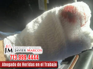 Abogado de Heridas en el Trabajo | Abogado Javier Marcos | 713.999.4444