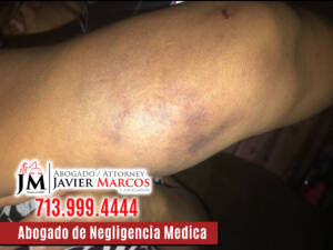 Abogado de Negligencia Medica | Abogado Javier Marcos | 713.999.4444