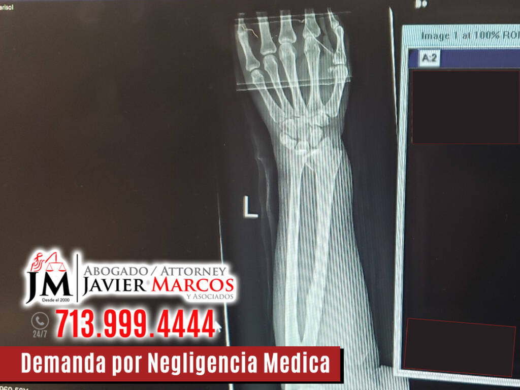 Demanda por Negligencia Medica | Abogado Javier Marcos | 713.999.4444